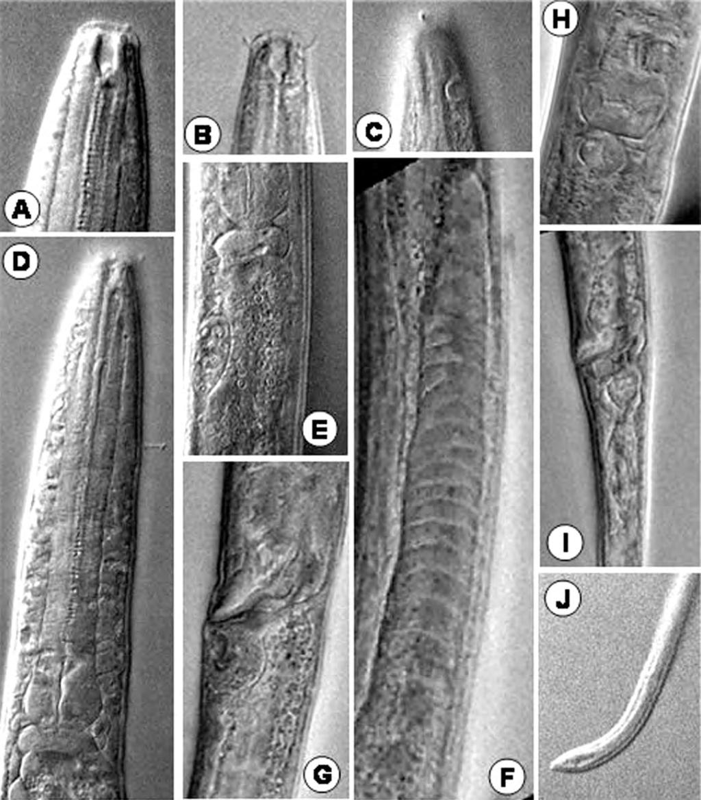 Khan et al. 69 posterior to base of cardia. Intestine thin-walled, transparent, granular with wide lumen. Rectum 10-12 µm long or 0.7-0.8 times anal body diameter. Anal opening crescent-shaped.