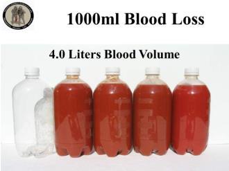TCCC for All Combatants 1708 Tactical Field Care Instructor Guide 22 73. 1000ml Blood Loss 4.0 Liters Blood Volume So let s say the casualty loses another 500ml of blood. How is he doing now? 74.