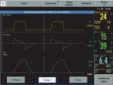 RECORDED WAVEFORMS Data recorded after pressing the Save fixed key is