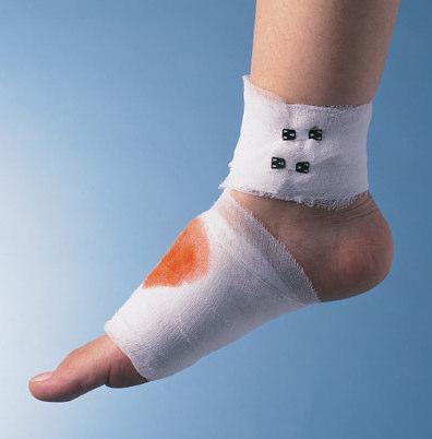 Foot Injury Statistics 180,000 footrelated injuries 400 injuries per day $6,000 per injury 1,509 lost-time injuries According to the National Safety Council, more than 180,000 foot-related injuries