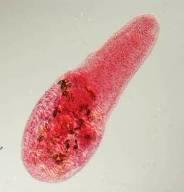 2. Intestinal Flukes ( Heteropyhidae; Echinostomatidae) ( minute intestinal trematodes 1.5-x 0.