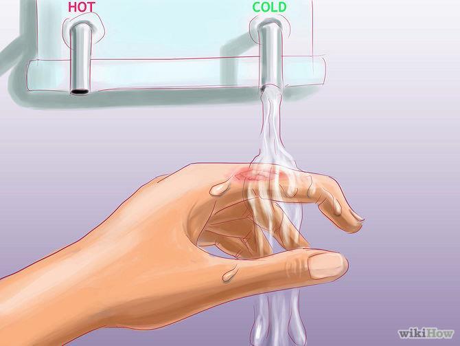 Flush with cool water for 5-10 minutes If chemical