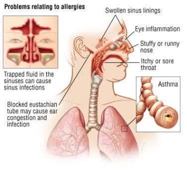 Effects of Air Contaminants the Respiratory System Gases and chemical can cause irritation of the cells lining the airways within the lungs.