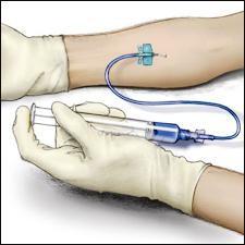 Take the needle out of the vein and use sterile gauze to put pressure on the infusion site for several