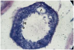 ovary of L. nebulosus (X1000).