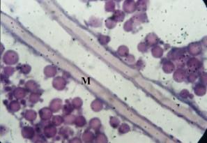 Plate 20: Developed vitellogenic oocyte membrane (M) in L.