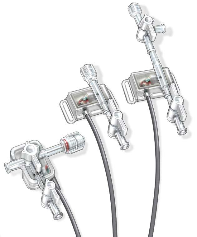 Perceptor DT Disposable Transducers from Navilyst Medical NAMIC Contrast Injection Lines are are designed specifically for interventional radiology labs and configured for both low- and high-