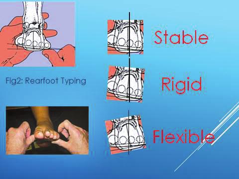 Think about it, do you really know how much first ray plantarflexion you ve pulled off and its effect on metatarsal positioning at toe-off when the patient is on the operative table?