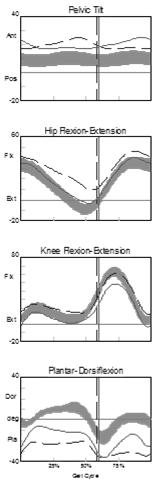 s in CP Sagittal Plane Compensation: voluntary equinus through out stance on the non-involved right side (solid line) Goal: provide symmetry in gait and reduced vertical displacement of the COM from