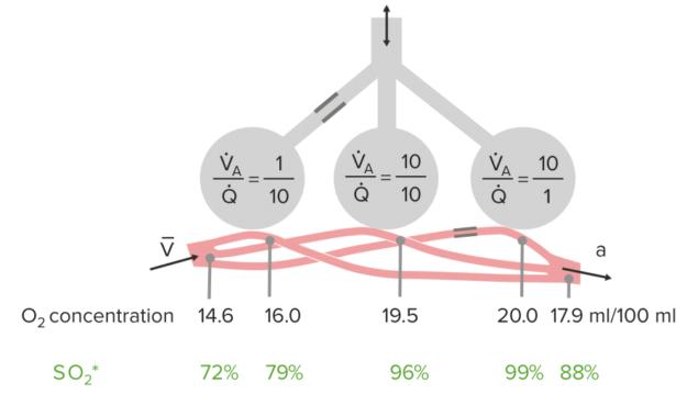 Ventilation to Perfusion Inequality Theoretical Examples Within the lungs, all the alveoli do not have uniform ventilation and perfusion; they tend to vary due to the effects of gravity.