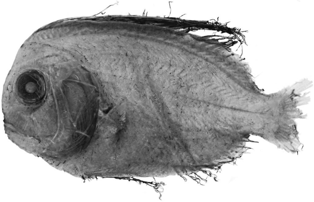 Stevenson and Kenaley Partial revision of Caristiidae 395 Fig. 9. Paracaristius nemorosus, new species (BMNH 2010.11.24.1, holotype, 83 mm SL). slightly posteriorly.