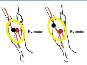 electrode ore posterior and proxial elicits ore eversion; and shifting the black electrode ore anterior and distal