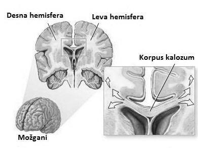 Slika : Leva in desna hemisfera in korpus kalozum (Kaneshiro 2010) Zunanji del velikih možganov se imenuje možganska skorja oz.