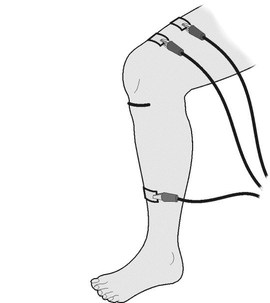 Experiment 14A Part II Patellar Reflex 10. Locate the subject s patellar tendon by feeling for the narrow band of tissue that connects the lower aspect of the patella to the tibia.