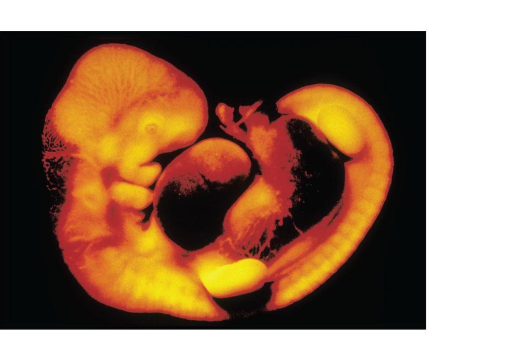 Figure 24-2 Chordate features in the human embryo eye heart