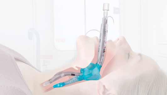 Airway algorithms recommend the usage of supraglottic airway devices (SAD) as options to overcome difficult scenario.