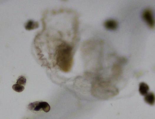 Figure 4. Various zooplankton as initial food source for young walleye fry to small fingerling. From left to right; rotifer, copepod and daphnia.
