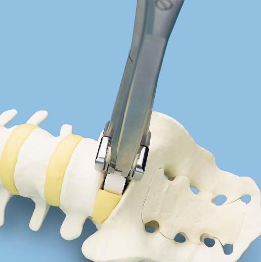 Tighten the locking screw on the Implant Holder to ensure that the jaws of the instrument are secure against the implant.