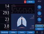 You can select from various layouts to display a combination of Intelligent Panels, including the Dynamic Lung, Vent Status, and ASV target graphics, plus traditional waveforms.