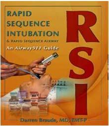Do You Need OR Time for RSI?