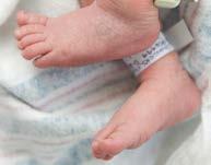 What Leaks Can Mean for NICU Patients Leaks place ventilated patients at a higher risk of auto-triggering, and can cause the ventilator to provide unwanted breaths.