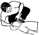 RECOVERY POSITION (Leave lying on their