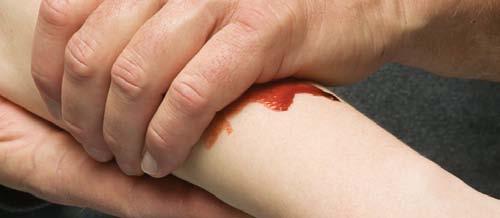 The highest risk of transmission while at work is unprotected direct or indirect contact with infected blood.