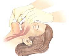 Suctioning is the process of removing foreign matter from the upper airway using a manual or mechanical device.