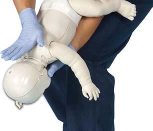 CHOKING Infant Note: Activate the EAP, size up the scene while forming an initial impression, obtain consent if a parent or guardian is present, use PPE, and care for any severe, life-threatening
