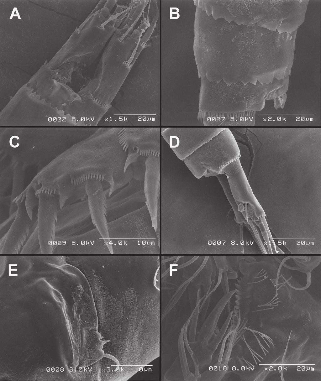 Endemism of subterranean Diacyclops in Korea and Japan, with descriptions... 67 Figure 26. Scanning electron micrographs, A C Diacyclops ishidai sp. n.