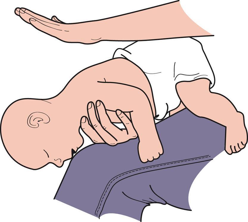 Basic CPR and First Aid Overview Basic CPR and