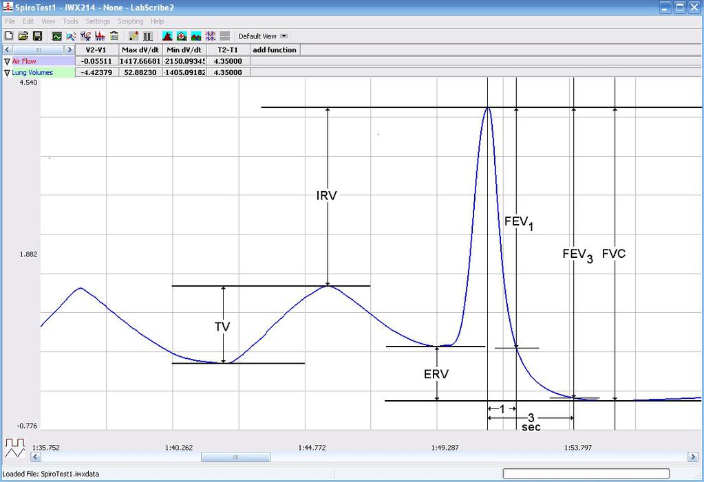 Figure HS-8-8: Recording of normal and forced lung volumes taken from a subject at rest, and displayed on the Lung Volumes channel in the Analysis window.