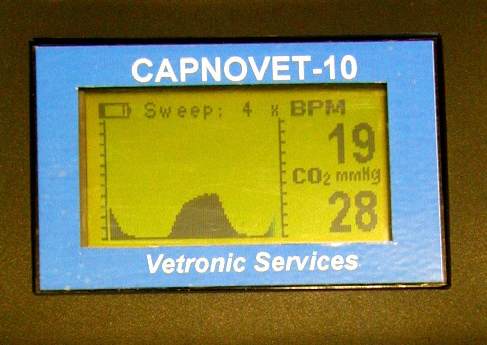 When we look at the screen of a typical capnograph we see something like this: Figure 1.01 typical display Capnograph machine We have a CO 2 value, a respiratory rate and a capnogram.