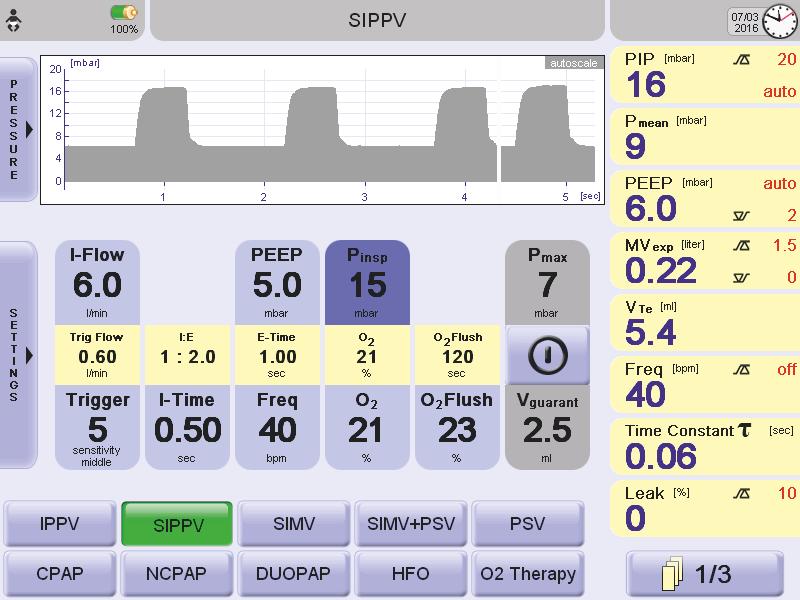 Option for realtime SpO2 monitoring with adjustable Perfusion Index (PI) alarm.