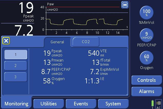 Ease of use Intuitive operation In close cooperation with users and ventilation experts, our engineers have designed the HAMILTON-C2 user interface to allow intuitive operation and direct access to