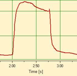 10.5.3 Pressure curve before Y-Piece The standard triggers can again be used for the pressure curve: (> 1 mbar / < 1 mbar).