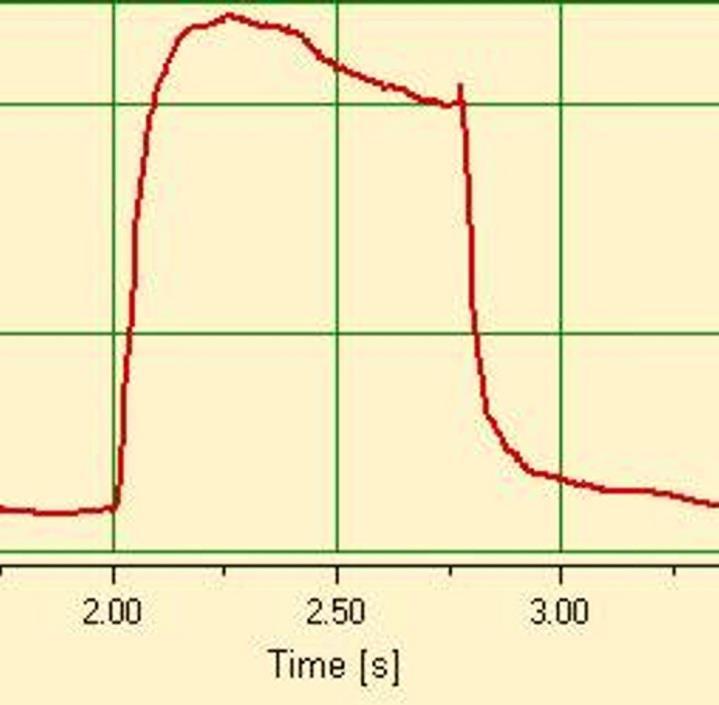 9.5.3 Pressure curve before Y-Piece The standard triggers can again be used for the pressure curve: (> 1 mbar / < 1 mbar).