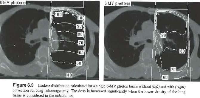 6Mv Beam From Bentel 2 nd edition p 101 Example of DVH DVH would be used to look at doses to normal
