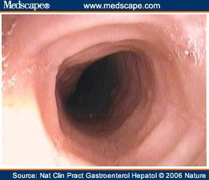 Esophagus 4-5 feet long Sphincter located at entrance to the