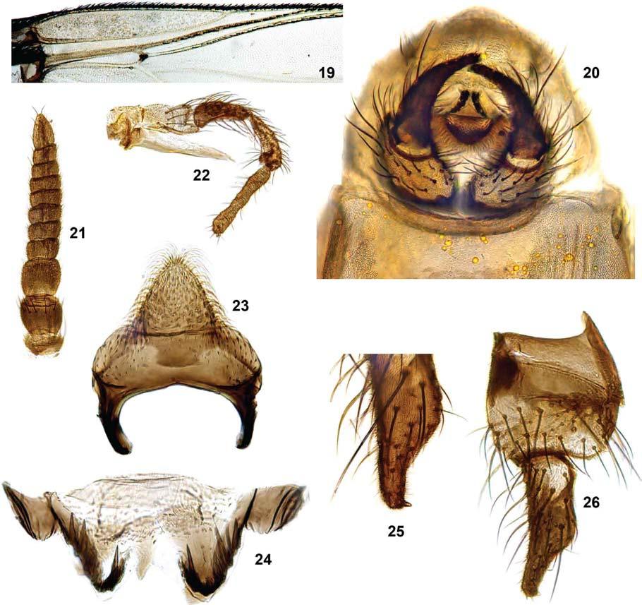 19: wing base; 20: terminalia in situ, ventral view; 21: antenna; 22: maxillary palp; 23: ventral plate;