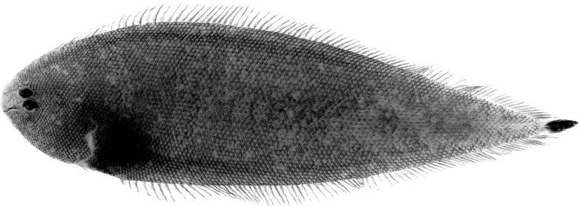 578 PROCEEDINGS OF THE BIOLOGICAL SOCIETY OF WASHINGTON Fig. 2. Symphurus ocellaris, paratype, male, 42.3 mm SL, USNM 378273, Pacific Panama.