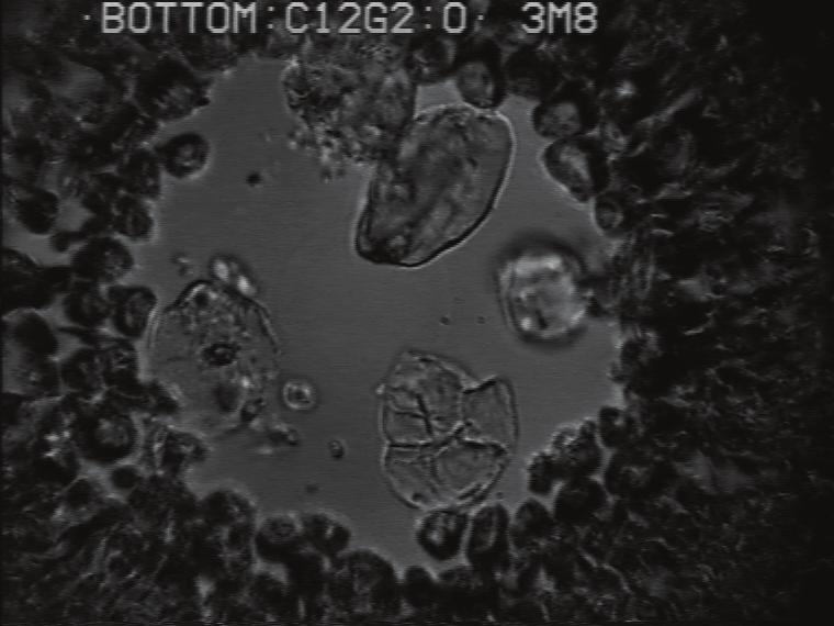 Figure 4 A bubble (200μm) stabilized by nano-particles at t=0 min (left) and t=45 min (right). 4. Foam films stabilized by nano-particles It has been known for a long time that small particles can stabilize emulsions (Pickering emulsions).