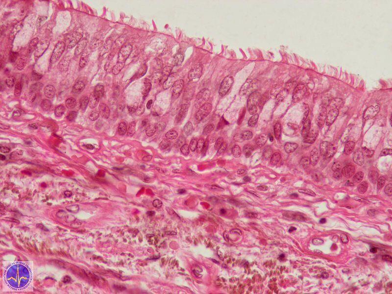 Clear, mucous-secreting goblet cells can be seen interspersed in the