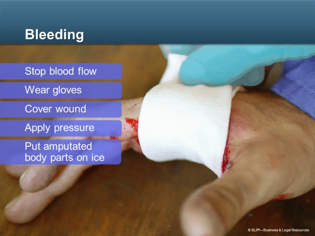 Heavy bleeding is another serious medical emergency. If a coworker is bleeding heavily, you have to stop the flow of blood while you wait for EMS personnel to arrive.