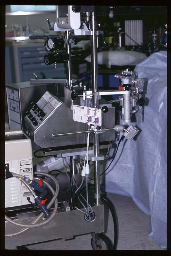 The Duke mini-circuit Oxygenator and Pumps at patient