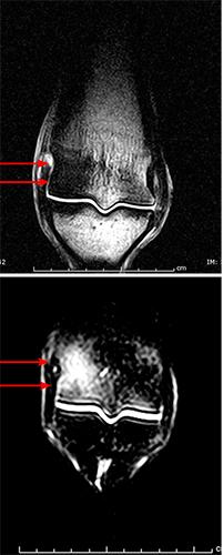 MRI pictures from normal horses s fetlock (red arrow cannon bone, white arrow long pastern bone, blue arrow flexor tendons).