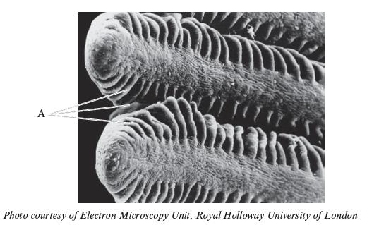 2. The photograph below shows a scanning electron micrograph of fish gills.