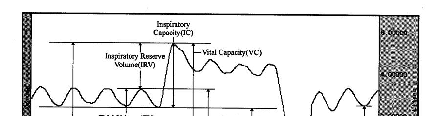 There are four non-overlapping primary compartments of total lung capacity: 1. Tidal volume (TV) is the volume of air inspired or expired during a single breath.