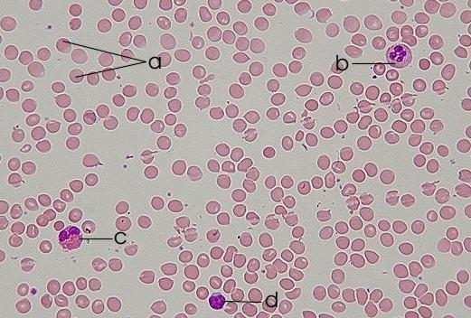 Blood Composi4on and Func4on Blood Consists of several kinds of cells suspended in a liquid matrix called plasma cellular elements occupy about 45% of the volume of blood Plasma 55% Constituent Major