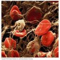 circulatory system Platelets Platelets